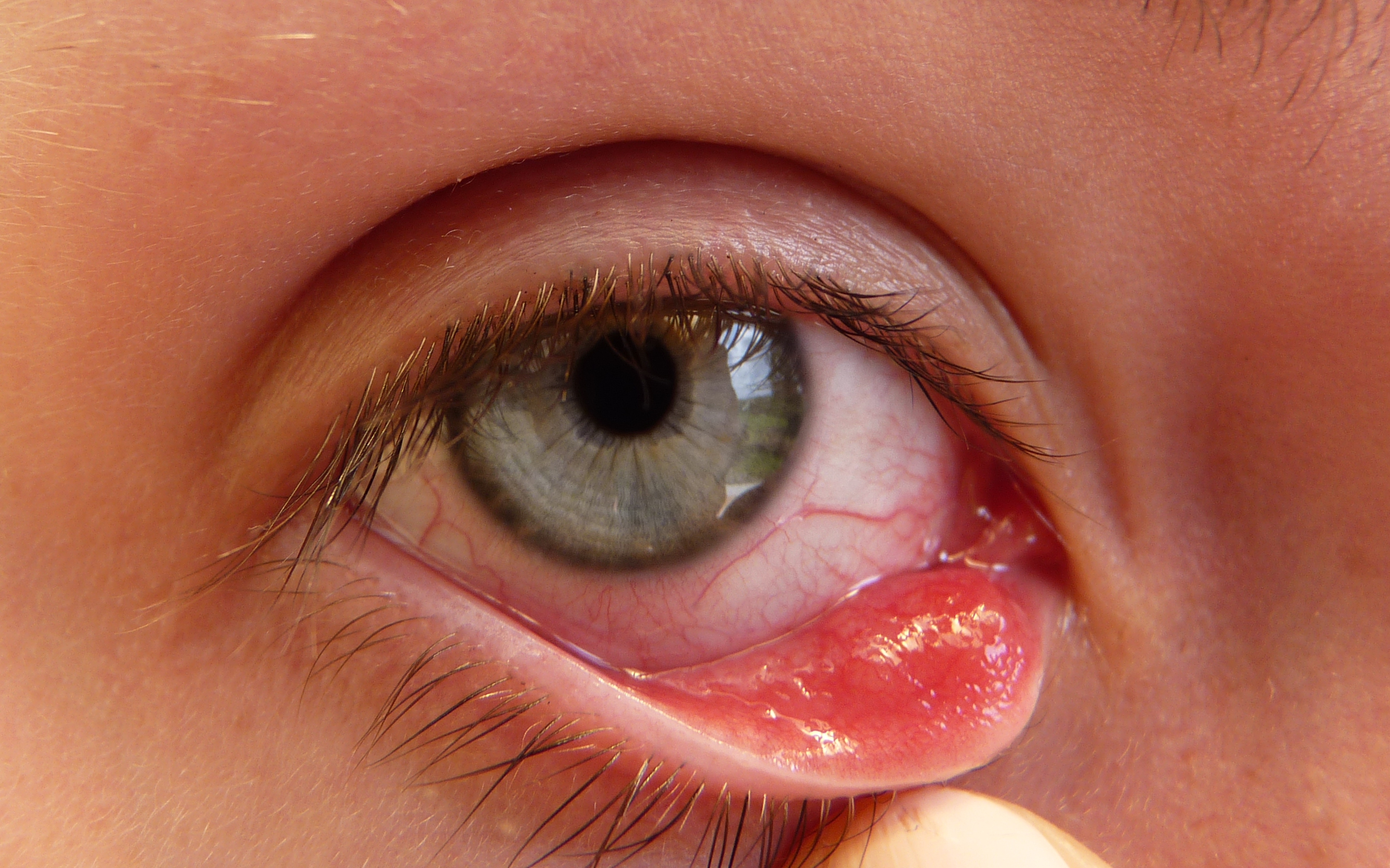 It’s Urine, Not Chlorine That Makes Your Kids’ Eyes Red