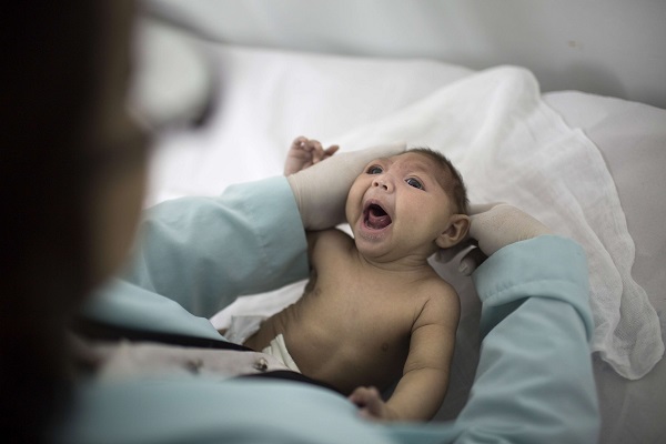 First Zika Baby in America Born in New Jersey